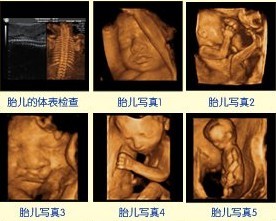 南阳市有四维彩超吗