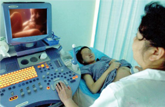孕晚期八个月的四维图