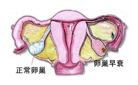 卵巢早衰的治疗方法