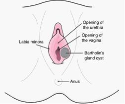 前庭大腺炎可以怀孕吗