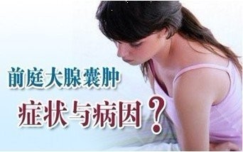前庭大腺囊肿